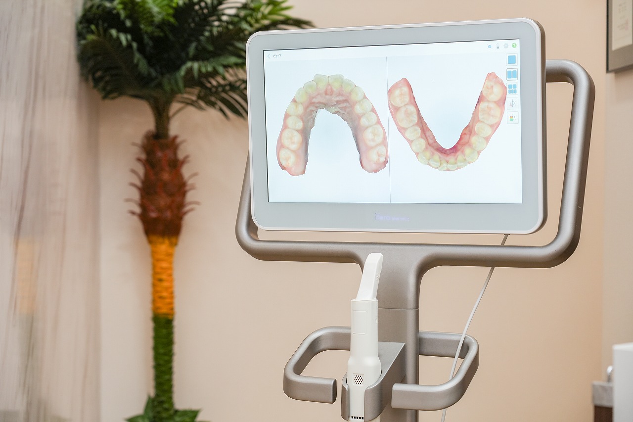 iTero Element（３Dスキャナー）