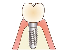 治療後のメンテナンス