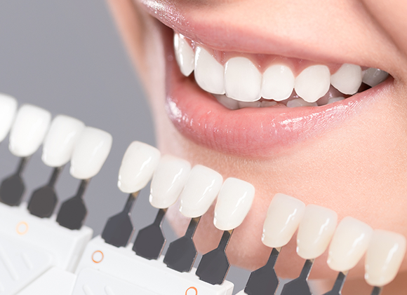 ホワイトニング