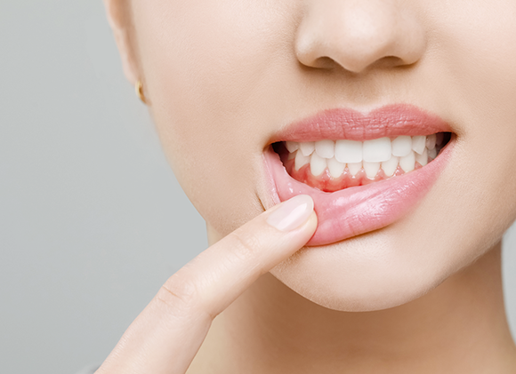 ガムピーリング