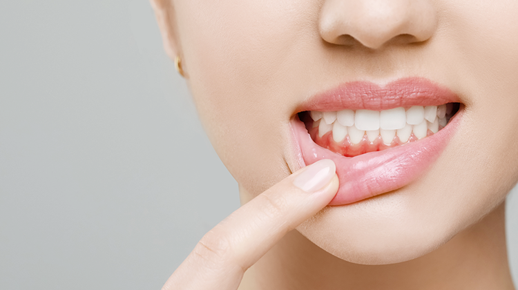 ガムピーリング