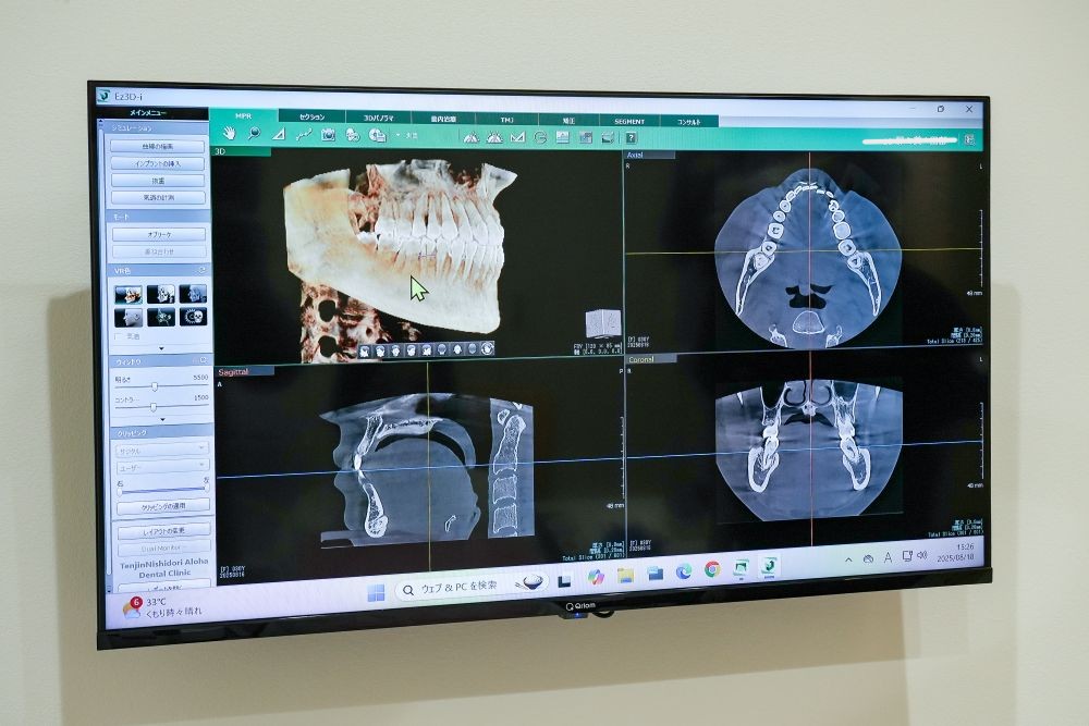 治療前の精密検査

