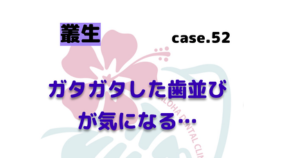 ガタガタした歯並びが気になる… ▶
