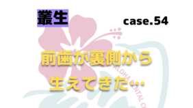 前歯が裏側から生えてきた　▶