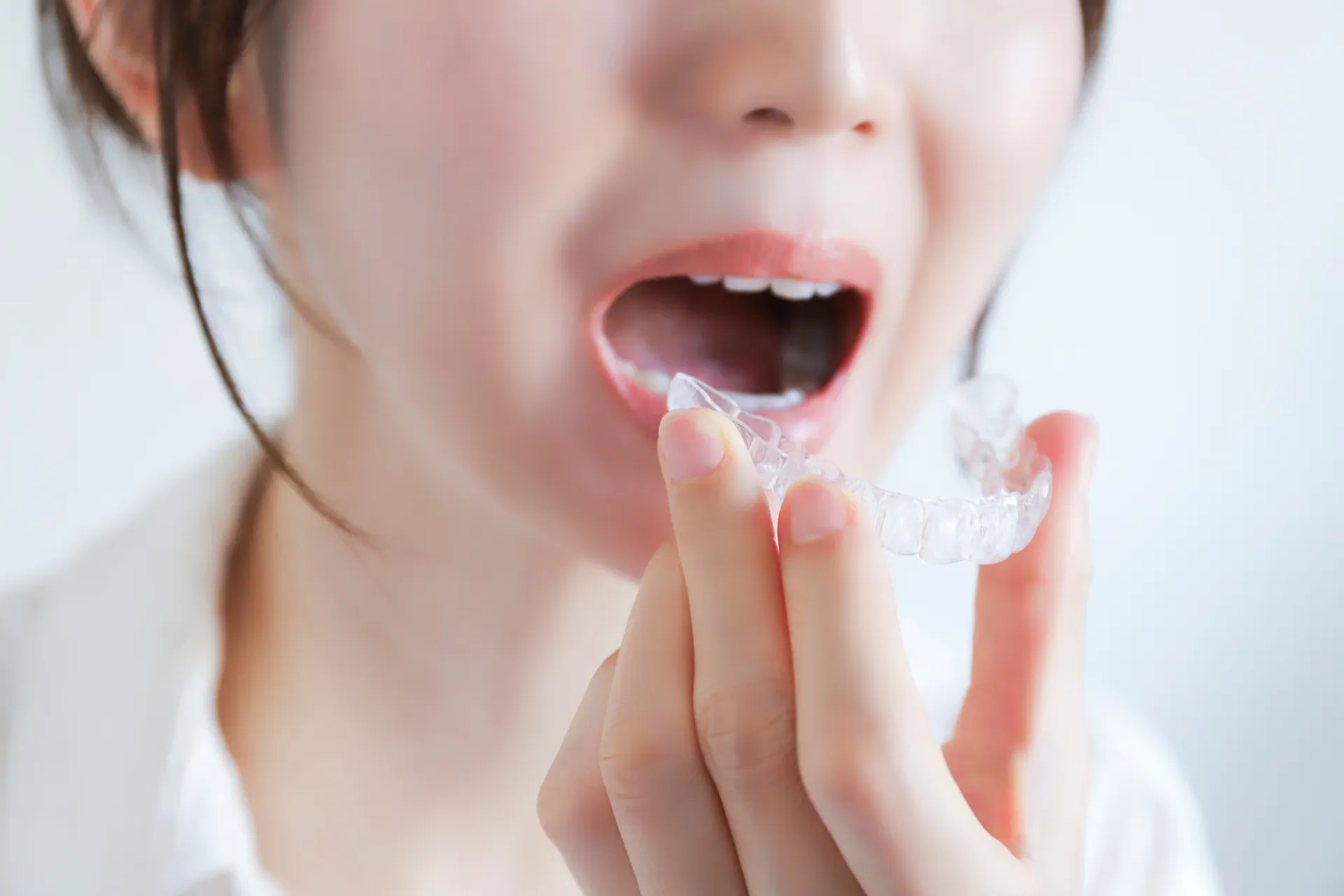 マウスピース矯正中の痛み・違和感はどれくらい？原因と対策を歯科医師が解説