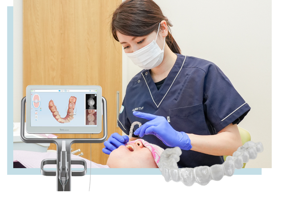 マウスピース矯正